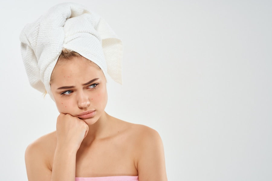 Body Acne Causes & Effective Remedies Saturn by GHC