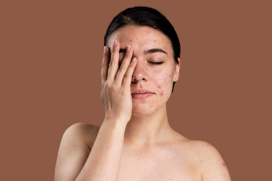 dry skin in summer