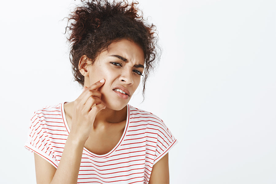 Say Goodbye to Heat Pimples Tips to Prevent Prickly Heat Saturn by GHC