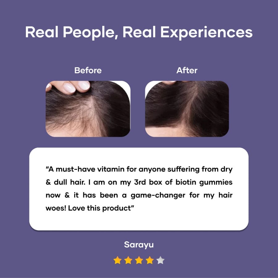 Biotin Gummies for Hair, Skin & Nails (30N)