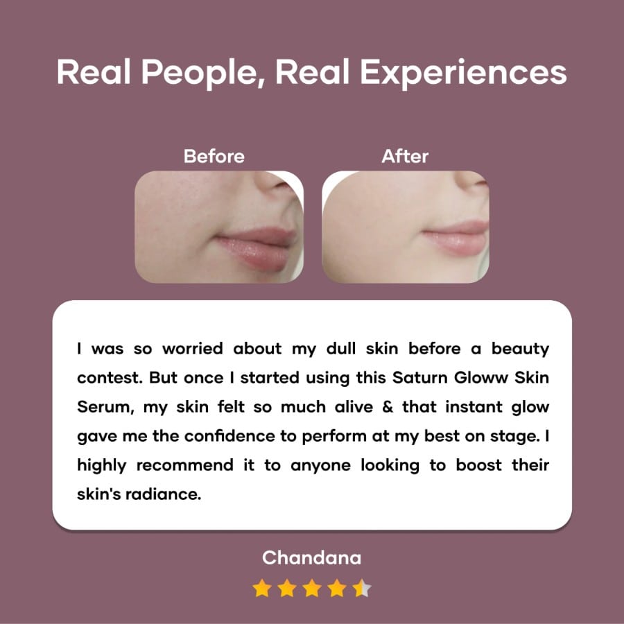 Gloww Skin Serum with Vitamin C &  Niacinamide