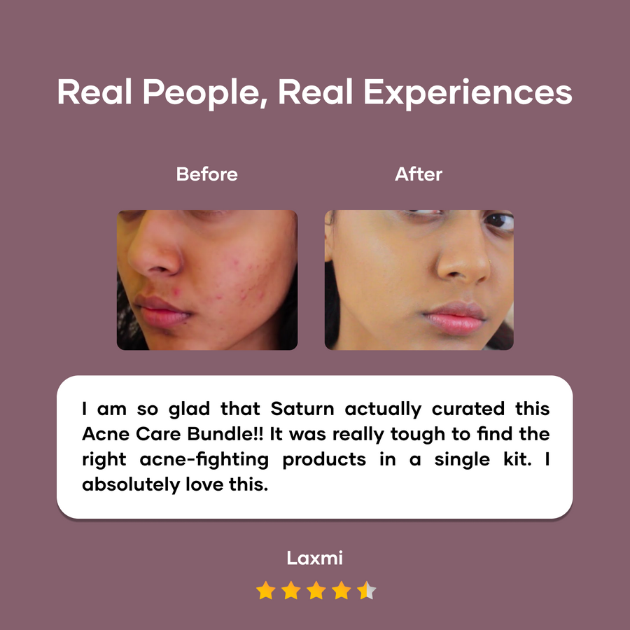 Ultimate Acne Care Regime