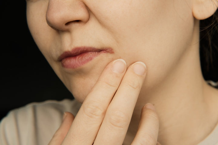 Causes, Prevention & Treatment for Cold Sore on Skin