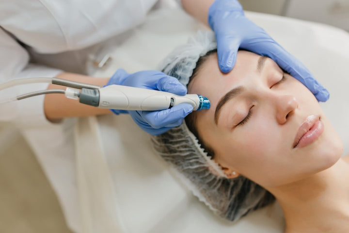 a woman getting mesotherapy treatment for her hair