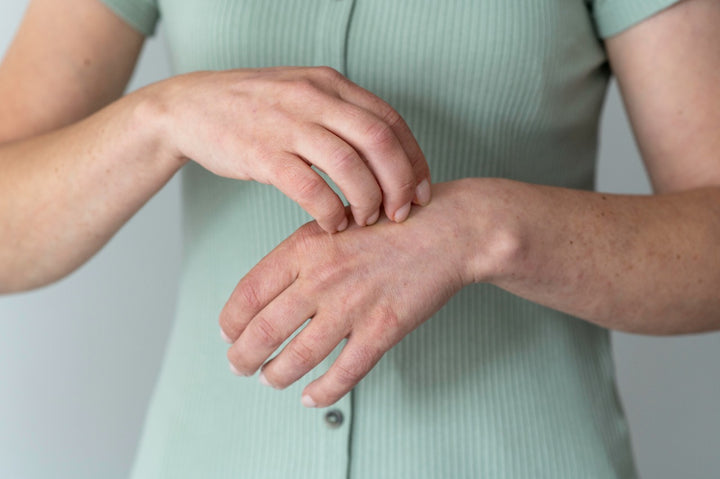 a woman scratching her hands
