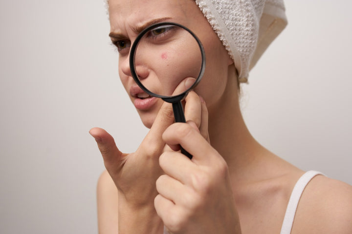 a woman examining her pimples using a magnifying glass