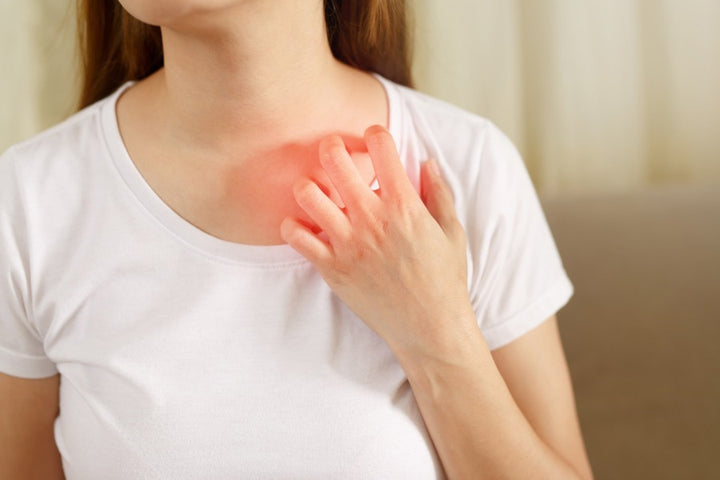 a woman scratching her neck due to rashes