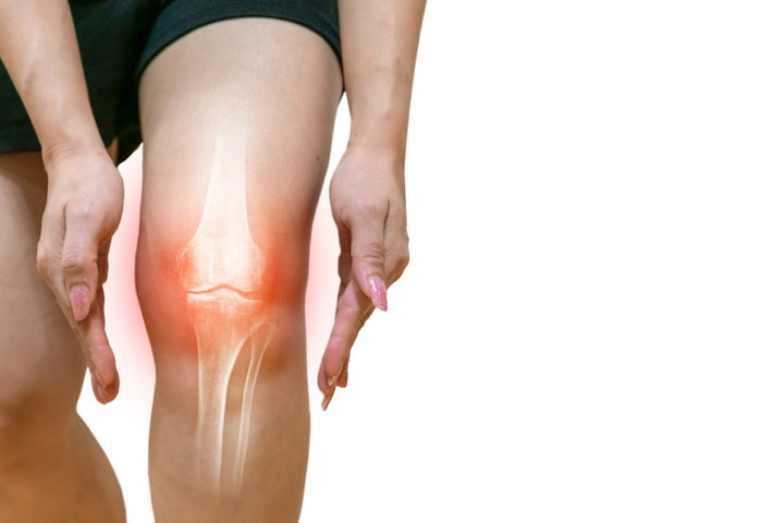a pictorial representation of a woman's knee joint