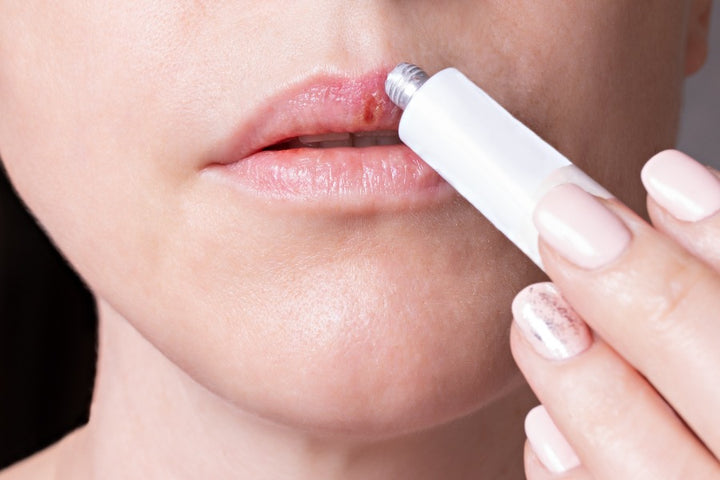 a woman applying ointment on her lips