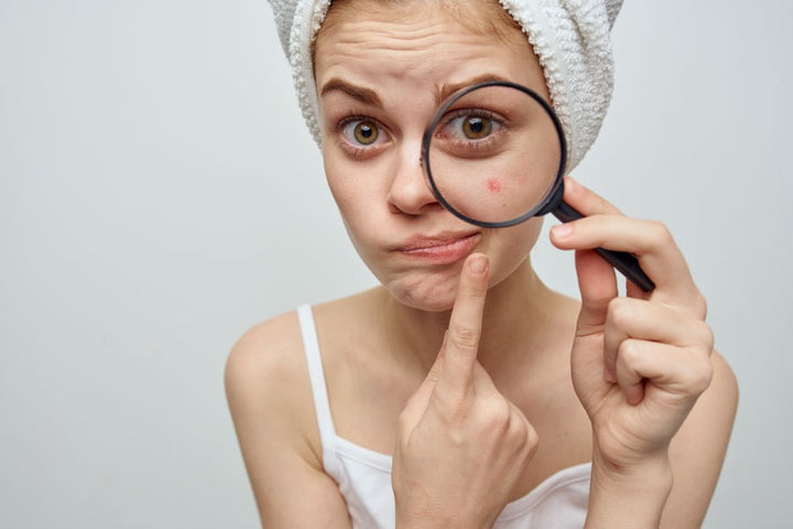 a woman using a magnifying glass to check her pimples | adult acne