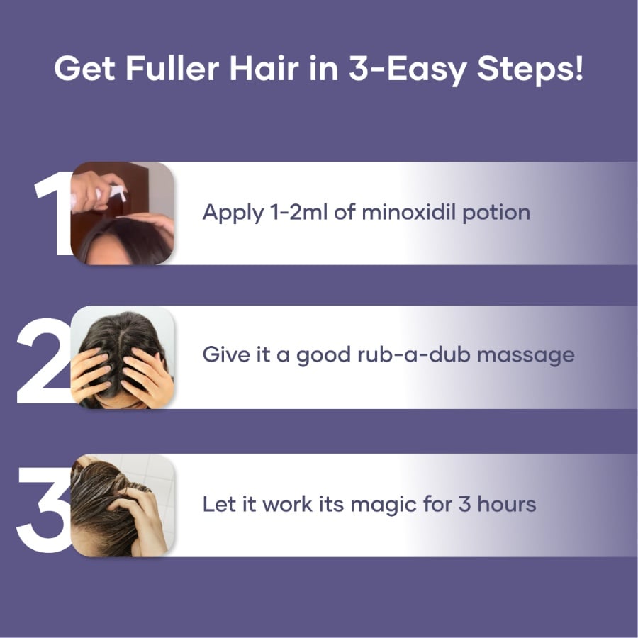 Minoxidil Solution for Hair Growth (60 ml) | Controls Hairfall